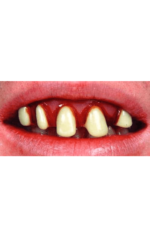 Originals (Billy-Bob Teeth) | Joke.co.uk